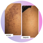 1-1.png_resize=150,150&ssl=1